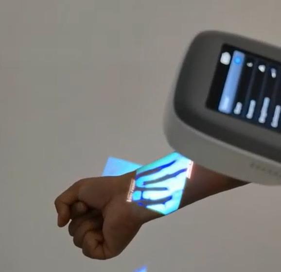 QV-600 Medical Vein Finder Vie - Medical Lab Images 评论和价格
